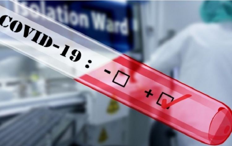 Жена от Рудозем е 16-ят заразен с covid-19 в област Смолян