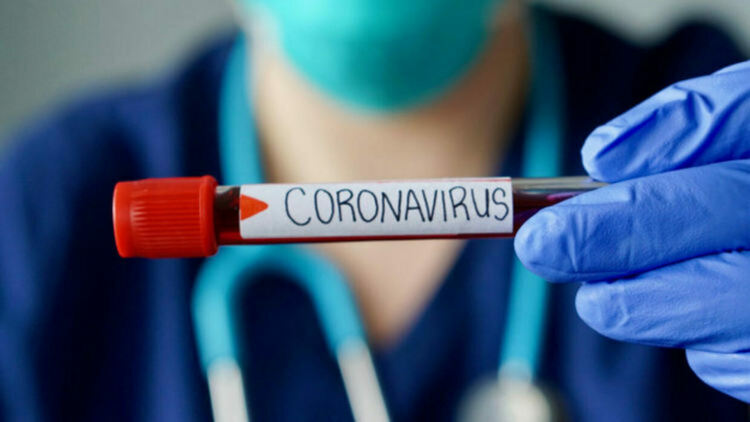 10 са починалите с COVID-19 в област Пловдив през почивните дни 
