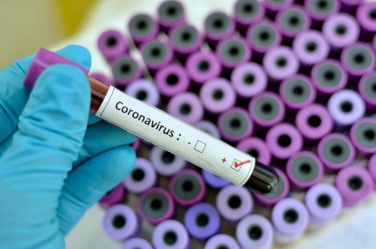 Броят на случаите на COVID-19 в област Пловдив продължава да расте