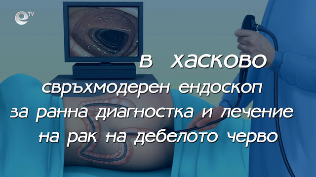 Свръхмодерен ендоскоп